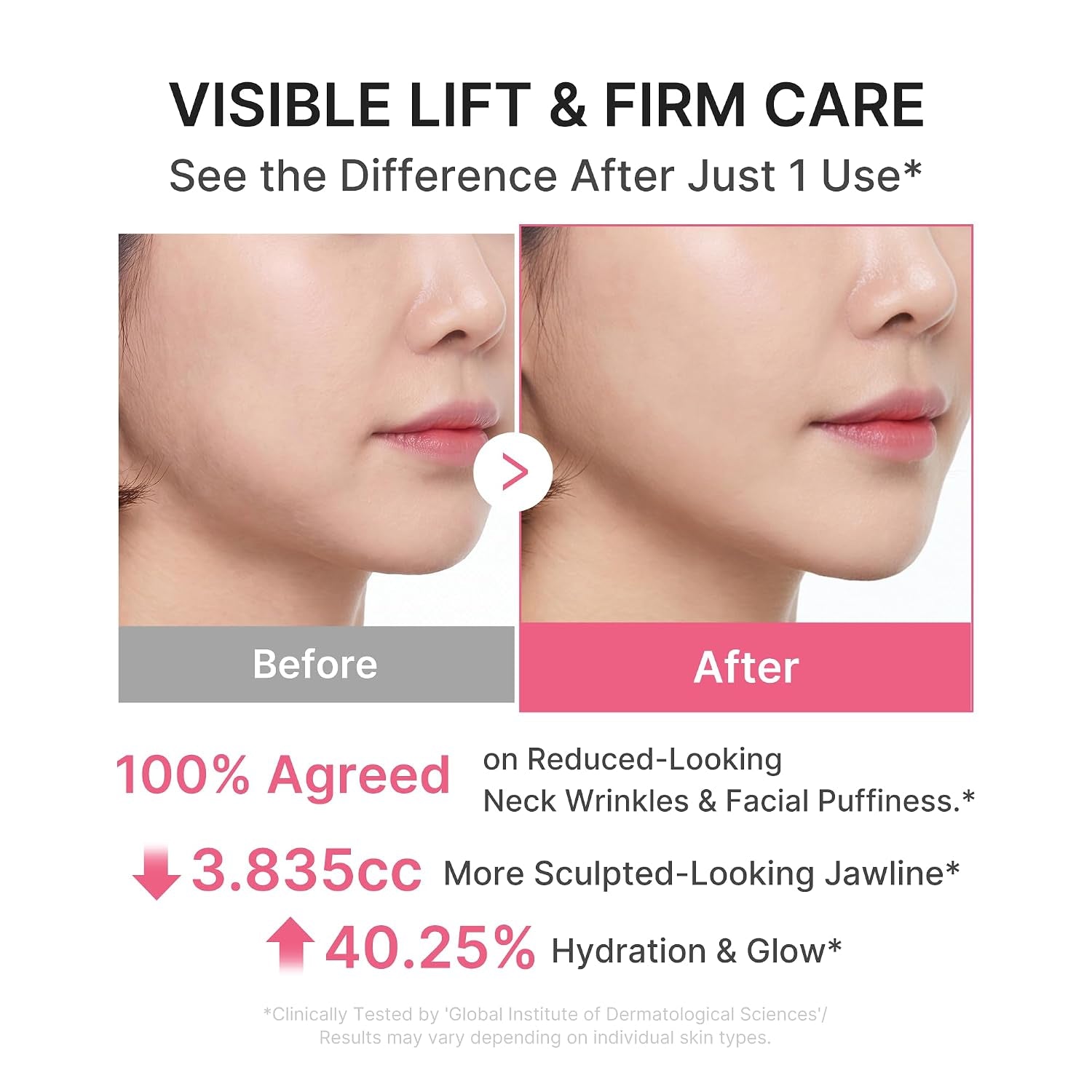 PDRN Collagen Gua Sha Neck Wrinkle Cream - Firming, Contour Care | Built-In Gua Sha Massager with Volufiline 5% - for the Look of Fine Lines, Jawline, Neck, Décolleté, Korean Skincare, 3.17 Oz
